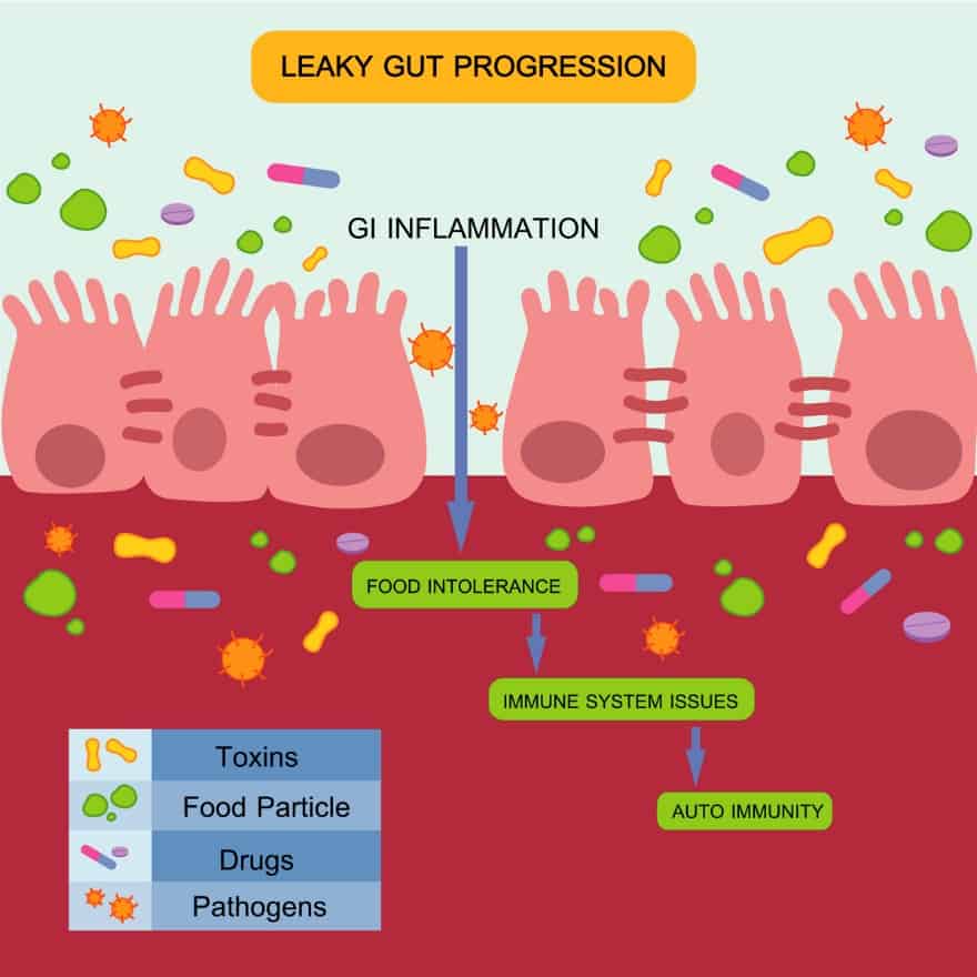 Microbiotic Plus probiotic - leaky gut progression